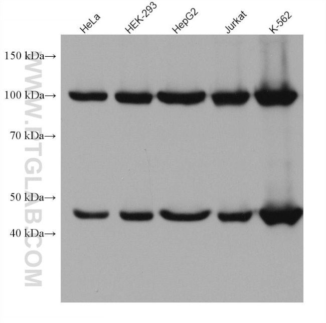 GART Antibody in Western Blot (WB)