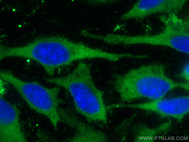 LARS Antibody in Immunocytochemistry (ICC/IF)