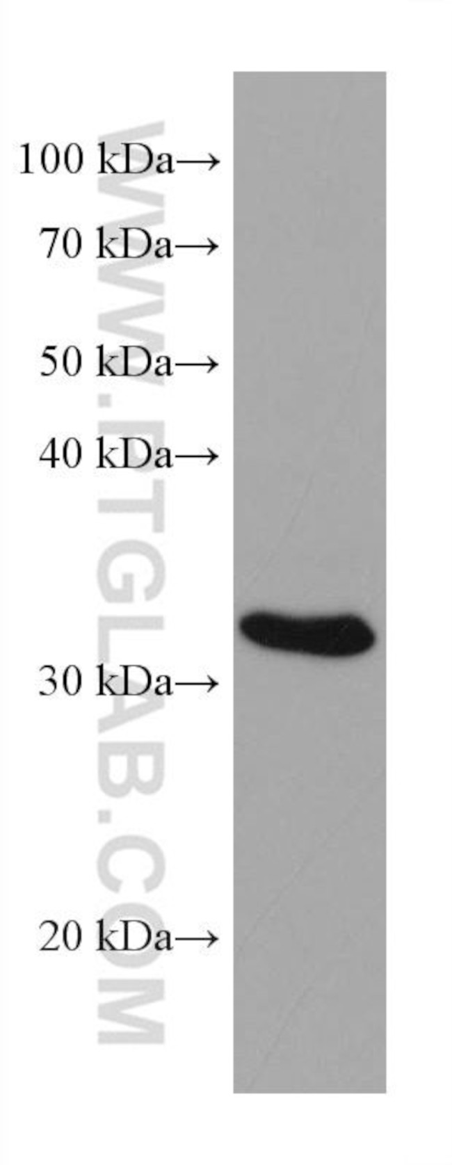 NAT1 Antibody in Western Blot (WB)