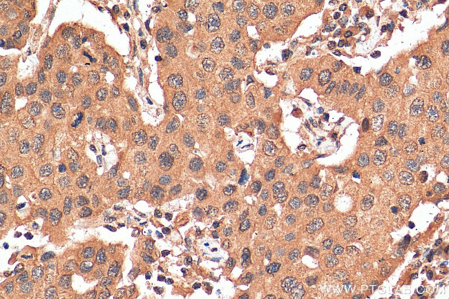 PARG Antibody in Immunohistochemistry (Paraffin) (IHC (P))