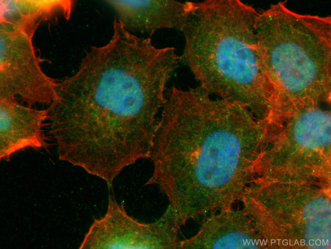 TNIK Antibody in Immunocytochemistry (ICC/IF)