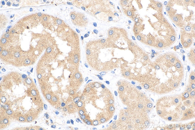 TNIK Antibody in Immunohistochemistry (Paraffin) (IHC (P))