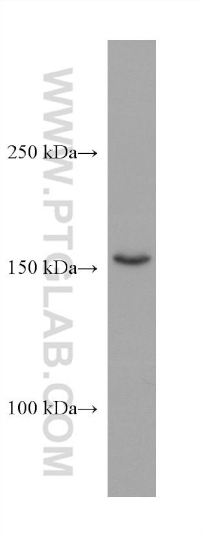 TNIK Antibody in Western Blot (WB)