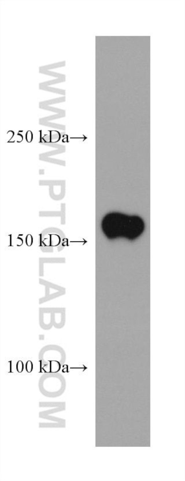 TNIK Antibody in Western Blot (WB)