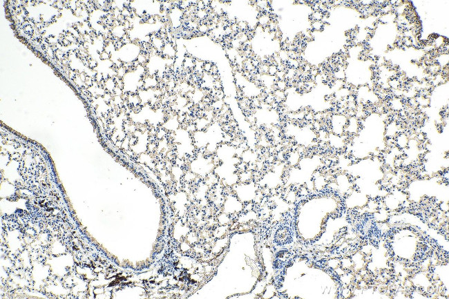 SERPINB9 Antibody in Immunohistochemistry (Paraffin) (IHC (P))