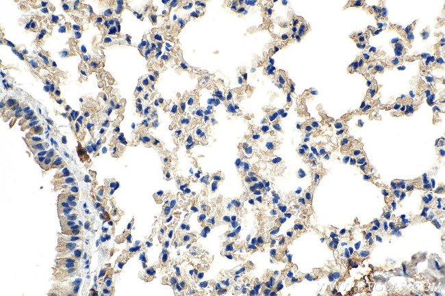 SERPINB9 Antibody in Immunohistochemistry (Paraffin) (IHC (P))