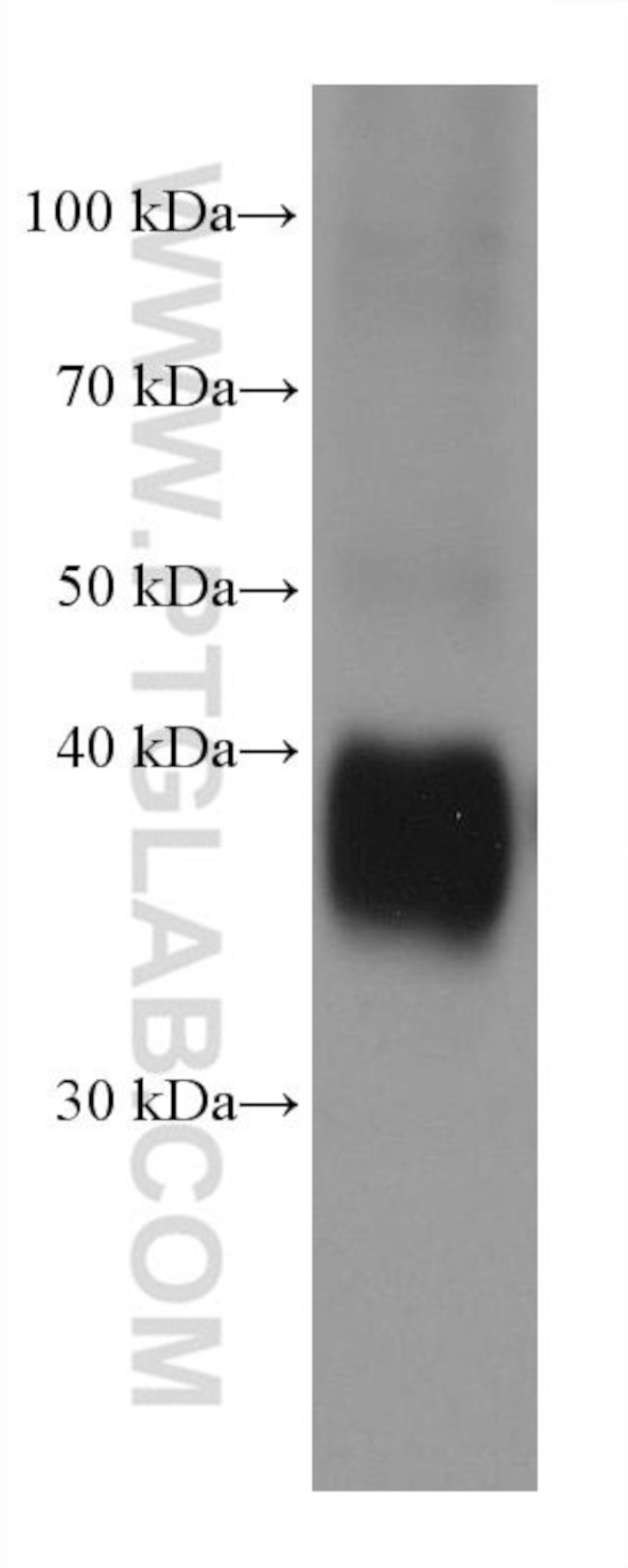 SERPINB9 Antibody in Western Blot (WB)