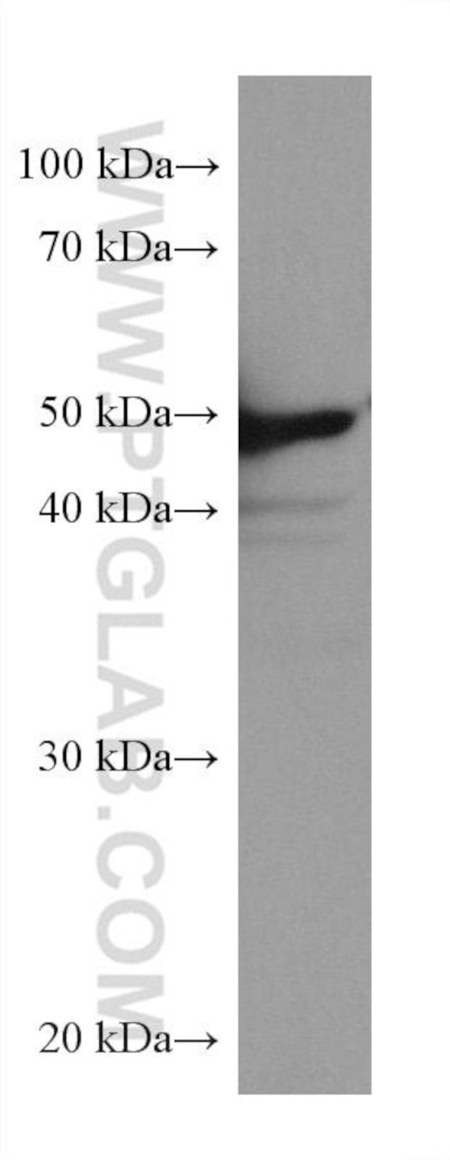 TrpRS Antibody in Western Blot (WB)