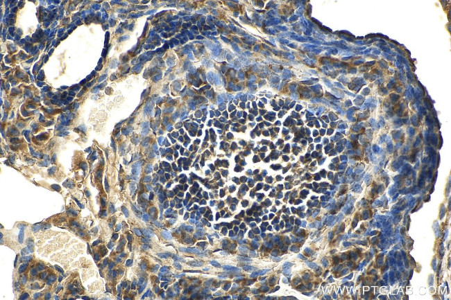 RAB14 Antibody in Immunohistochemistry (Paraffin) (IHC (P))