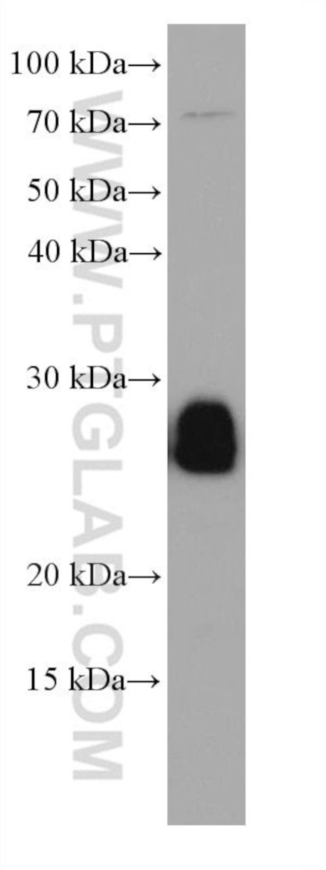 RAB14 Antibody in Western Blot (WB)