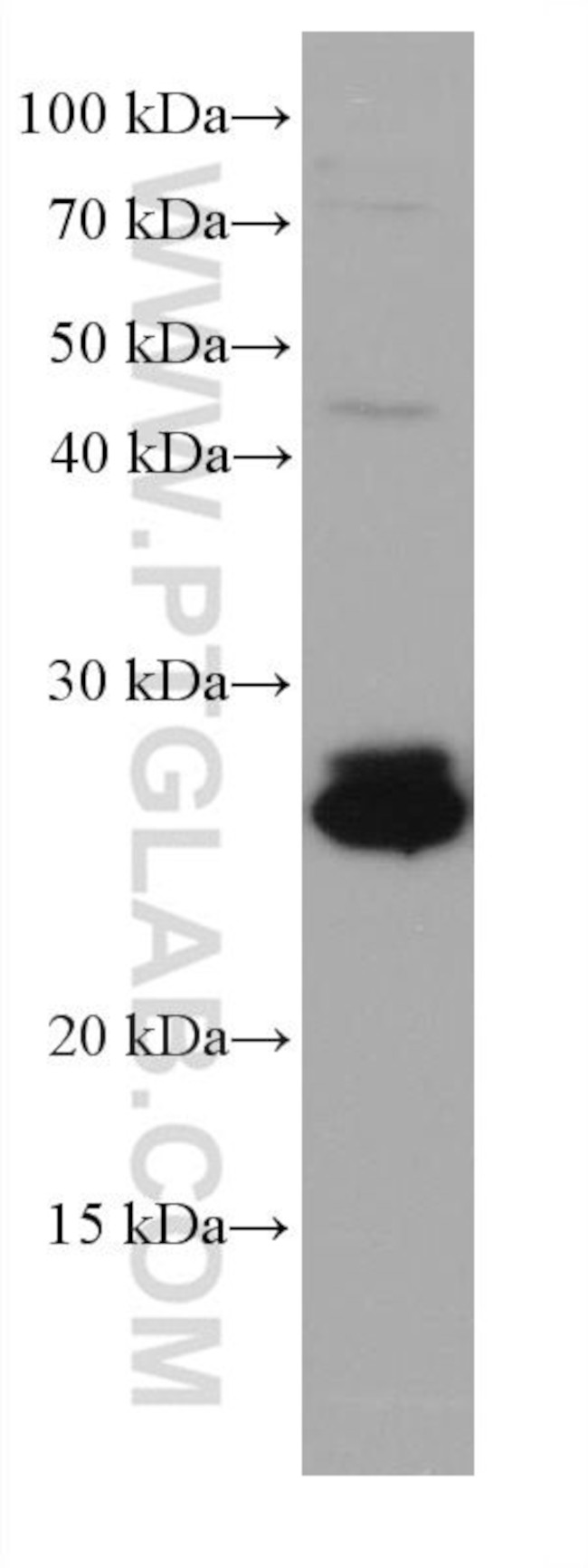 RAB14 Antibody in Western Blot (WB)