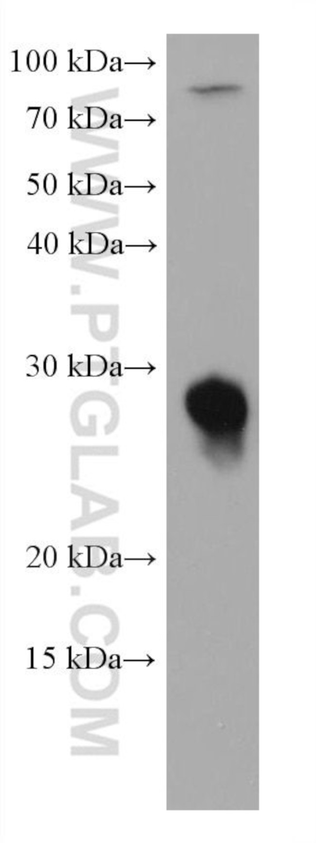 RAB14 Antibody in Western Blot (WB)