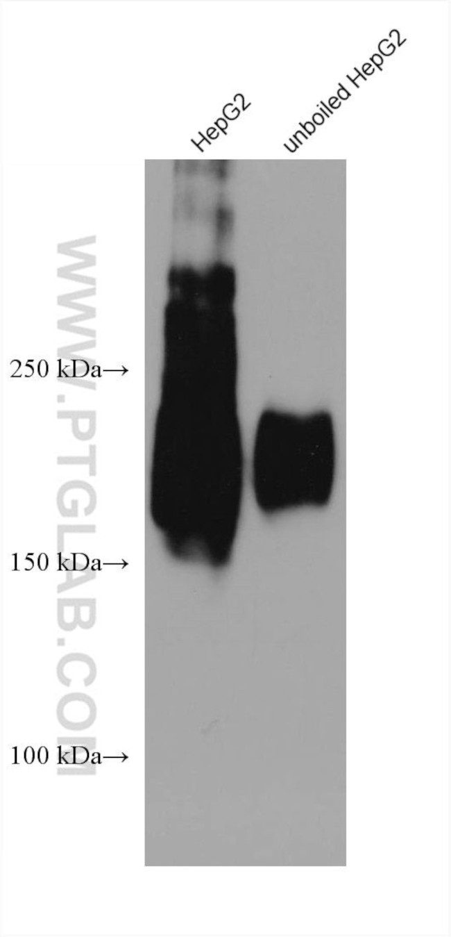 ABCC5 Antibody in Western Blot (WB)