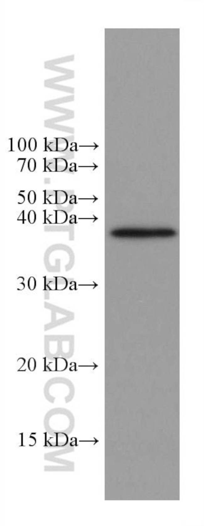 Caspase 7 Antibody in Western Blot (WB)