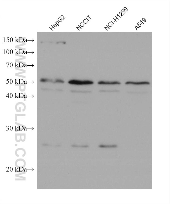 CLN3 Antibody in Western Blot (WB)