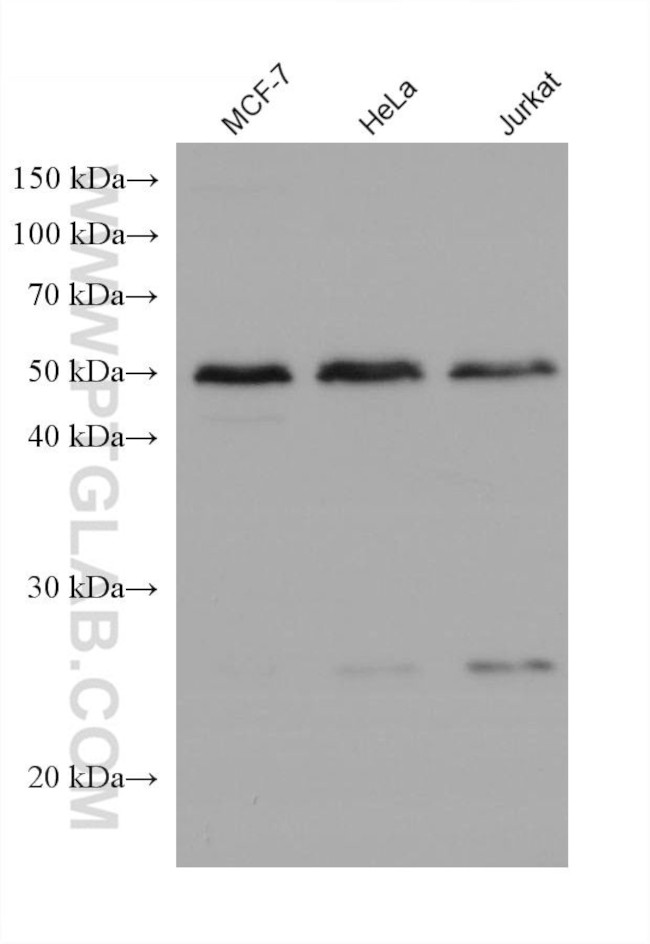 CLN3 Antibody in Western Blot (WB)