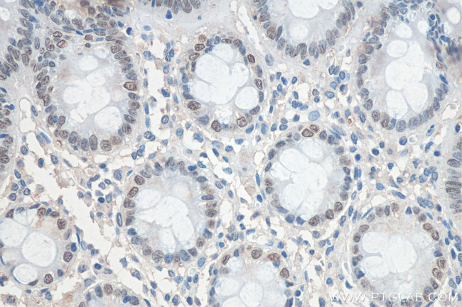 SATB2 Antibody in Immunohistochemistry (Paraffin) (IHC (P))