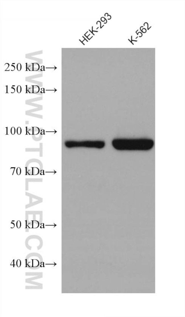 SATB2 Antibody in Western Blot (WB)