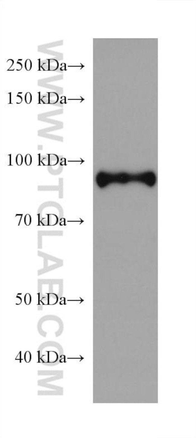 SATB2 Antibody in Western Blot (WB)