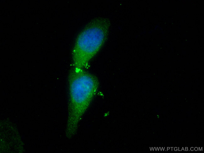 PSMB5 Antibody in Immunocytochemistry (ICC/IF)