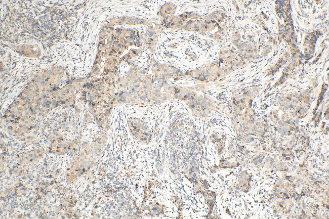 PSMB5 Antibody in Immunohistochemistry (Paraffin) (IHC (P))