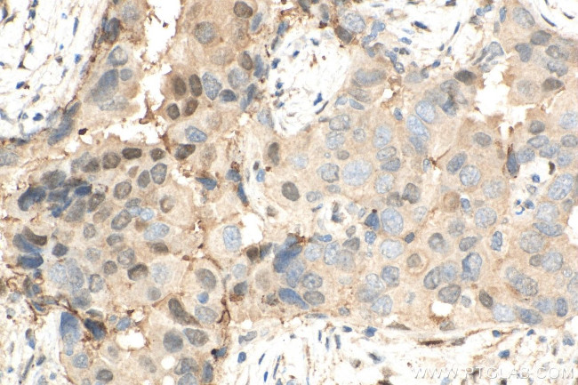 PSMB5 Antibody in Immunohistochemistry (Paraffin) (IHC (P))