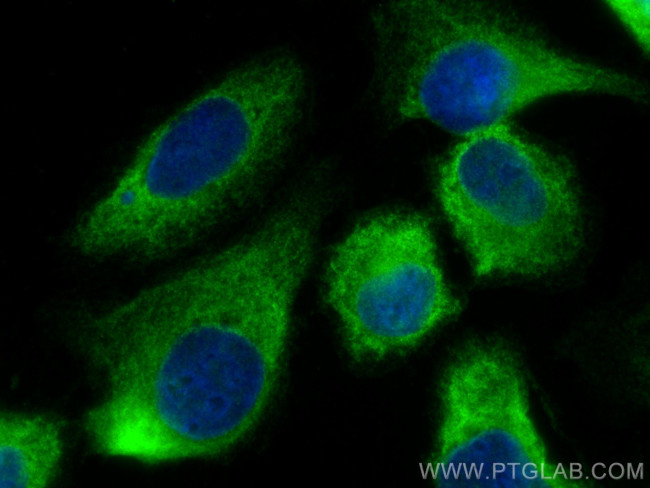 ABCE1 Antibody in Immunocytochemistry (ICC/IF)