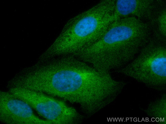 ABCE1 Antibody in Immunocytochemistry (ICC/IF)