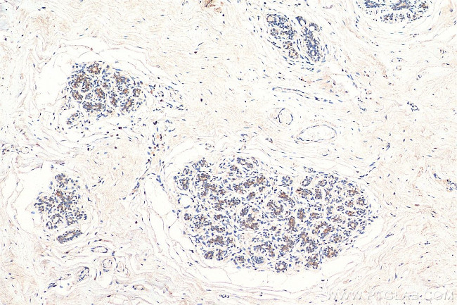 ABCE1 Antibody in Immunohistochemistry (Paraffin) (IHC (P))