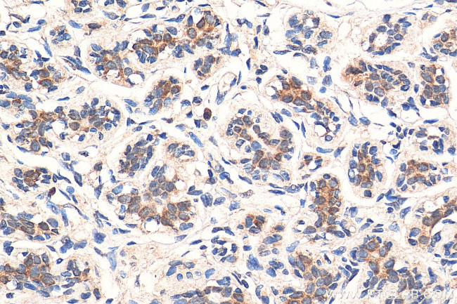 ABCE1 Antibody in Immunohistochemistry (Paraffin) (IHC (P))