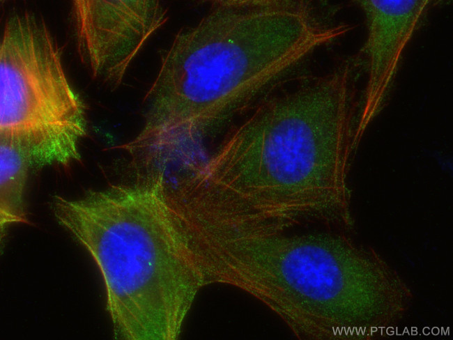 CCT6B Antibody in Immunocytochemistry (ICC/IF)