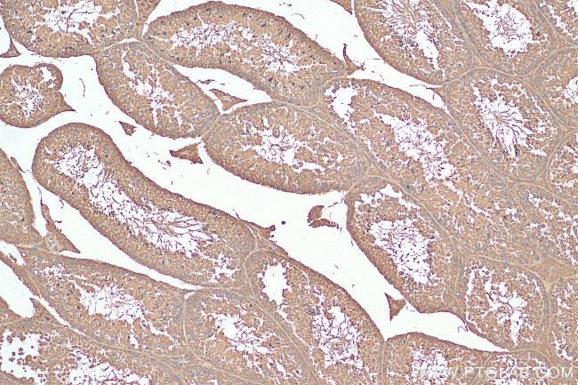 CCT6B Antibody in Immunohistochemistry (Paraffin) (IHC (P))