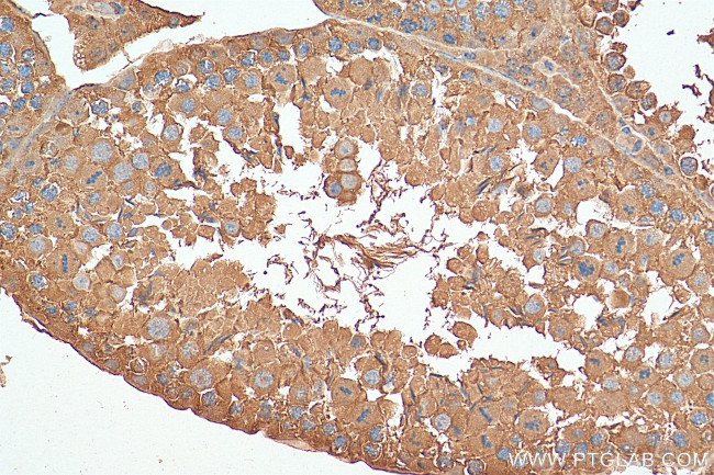 CCT6B Antibody in Immunohistochemistry (Paraffin) (IHC (P))