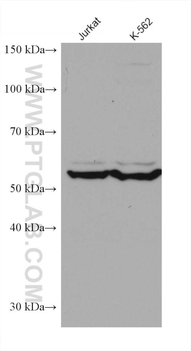 CCT6B Antibody in Western Blot (WB)