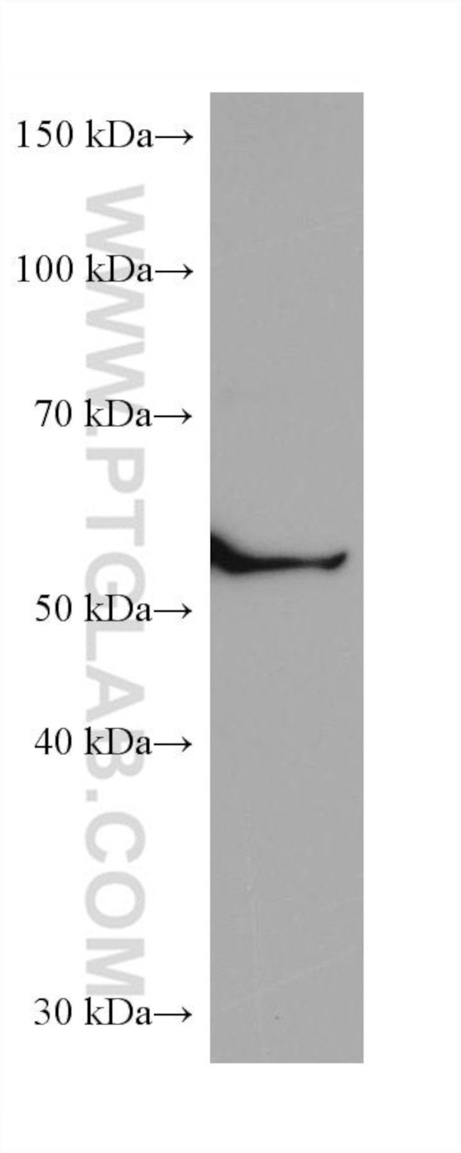 CCT6B Antibody in Western Blot (WB)