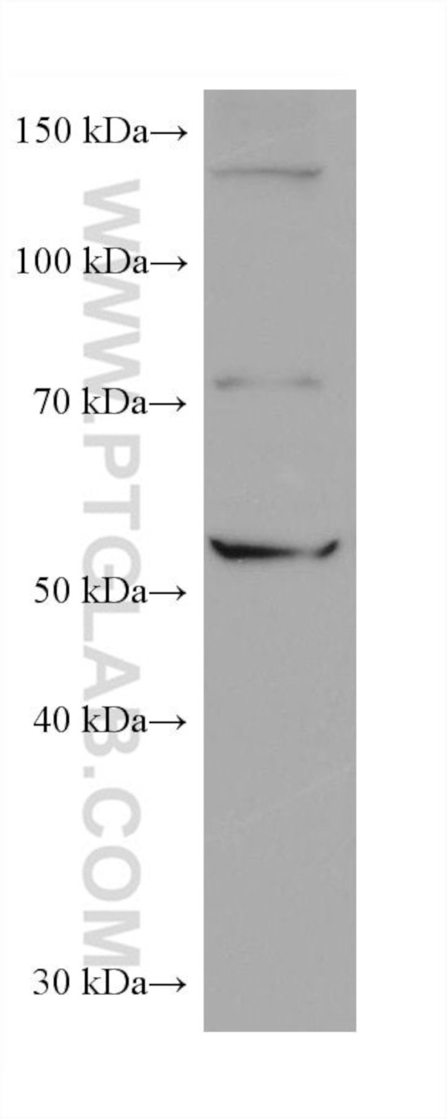 CCT6B Antibody in Western Blot (WB)