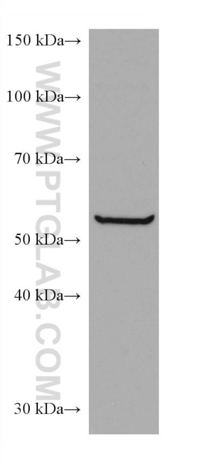 CCT6B Antibody in Western Blot (WB)