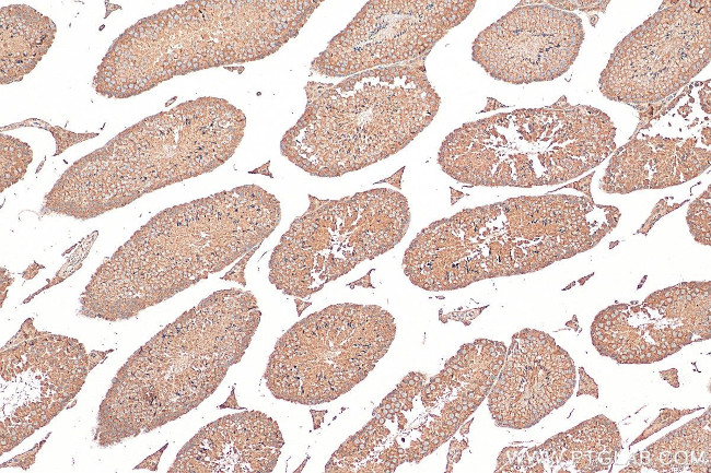 IPO5 Antibody in Immunohistochemistry (Paraffin) (IHC (P))