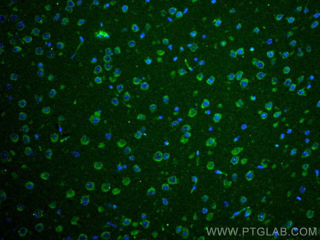 MFSD2 Antibody in Immunohistochemistry (Paraffin) (IHC (P))