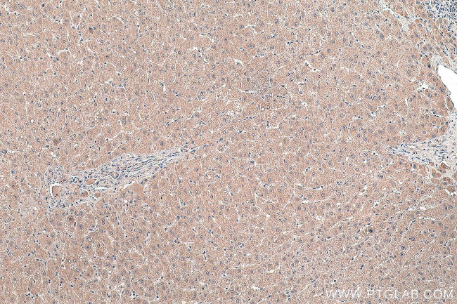 MYD88 Antibody in Immunohistochemistry (Paraffin) (IHC (P))