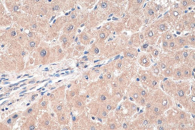 MYD88 Antibody in Immunohistochemistry (Paraffin) (IHC (P))