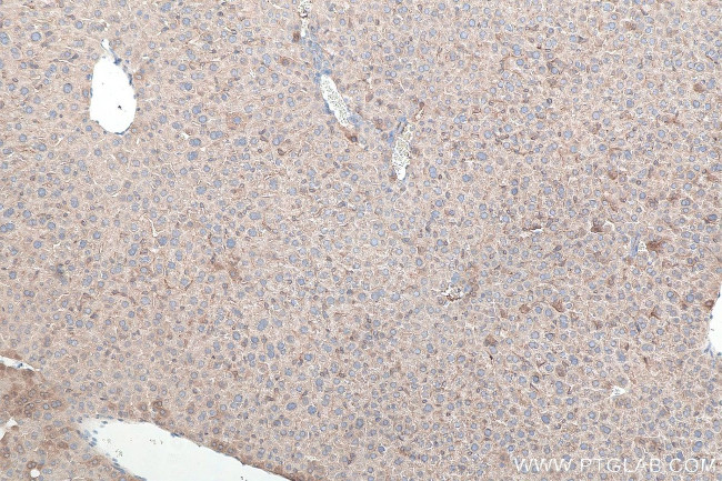 MYD88 Antibody in Immunohistochemistry (Paraffin) (IHC (P))