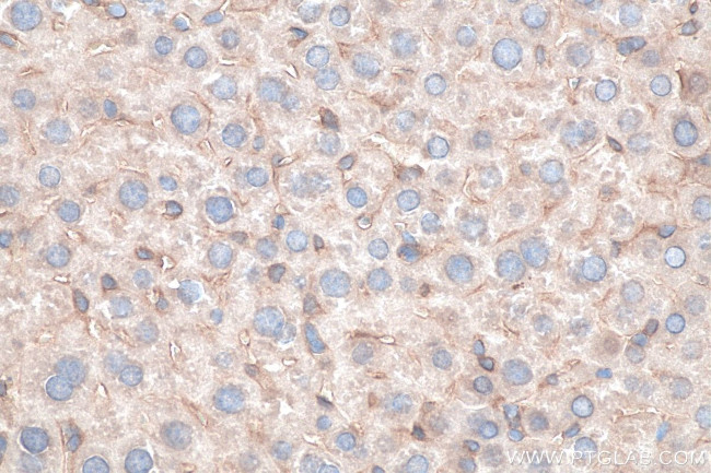 MYD88 Antibody in Immunohistochemistry (Paraffin) (IHC (P))