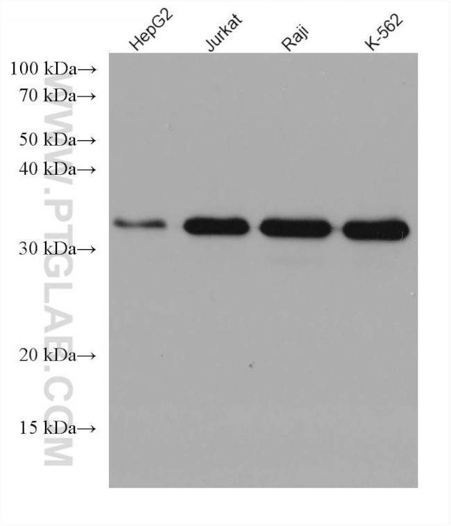 MYD88 Antibody in Western Blot (WB)