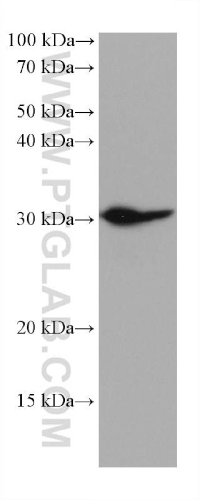 MYD88 Antibody in Western Blot (WB)