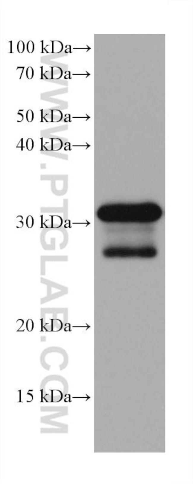 MYD88 Antibody in Western Blot (WB)