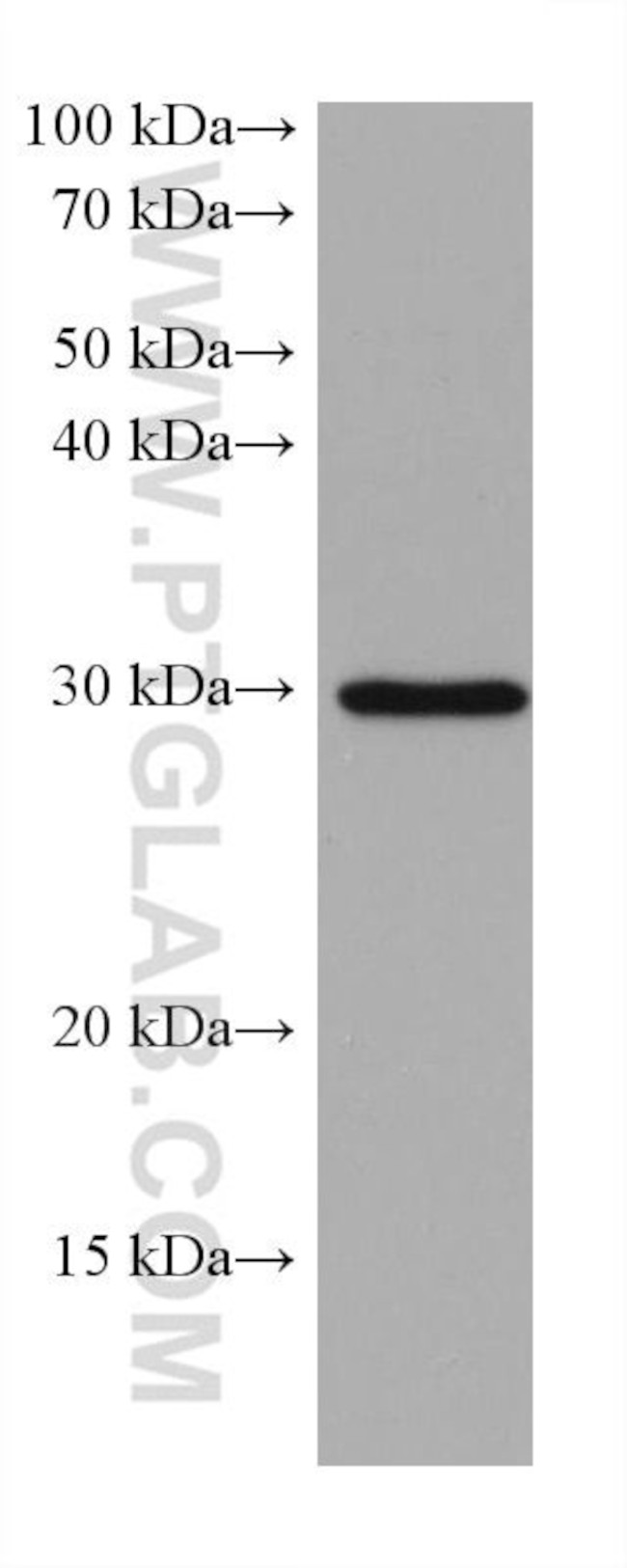 MYD88 Antibody in Western Blot (WB)