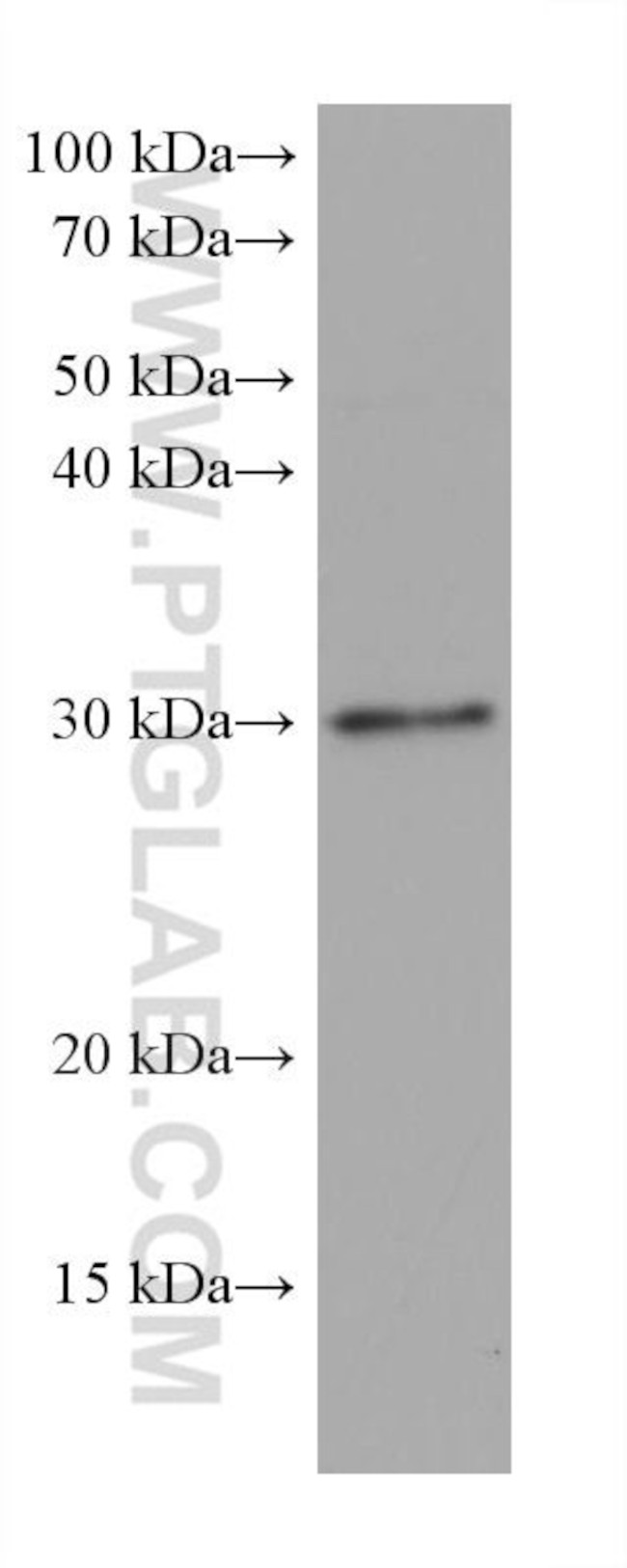 MYD88 Antibody in Western Blot (WB)