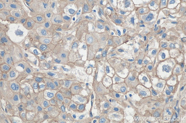 SPTBN1 Antibody in Immunohistochemistry (Paraffin) (IHC (P))