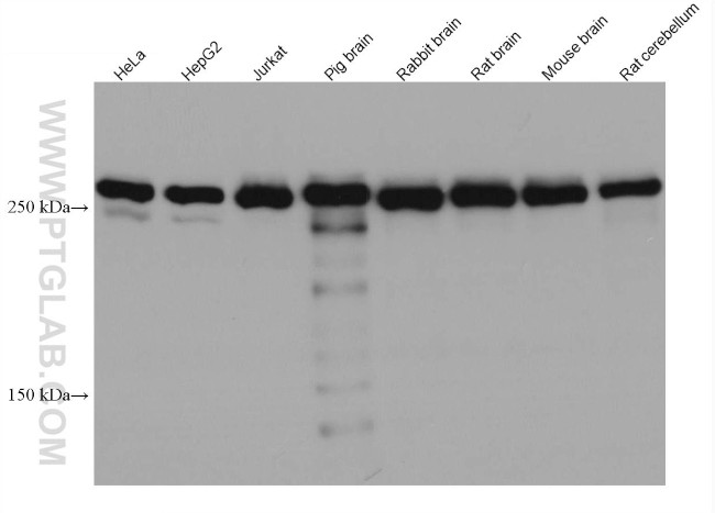 SPTBN1 Antibody in Western Blot (WB)